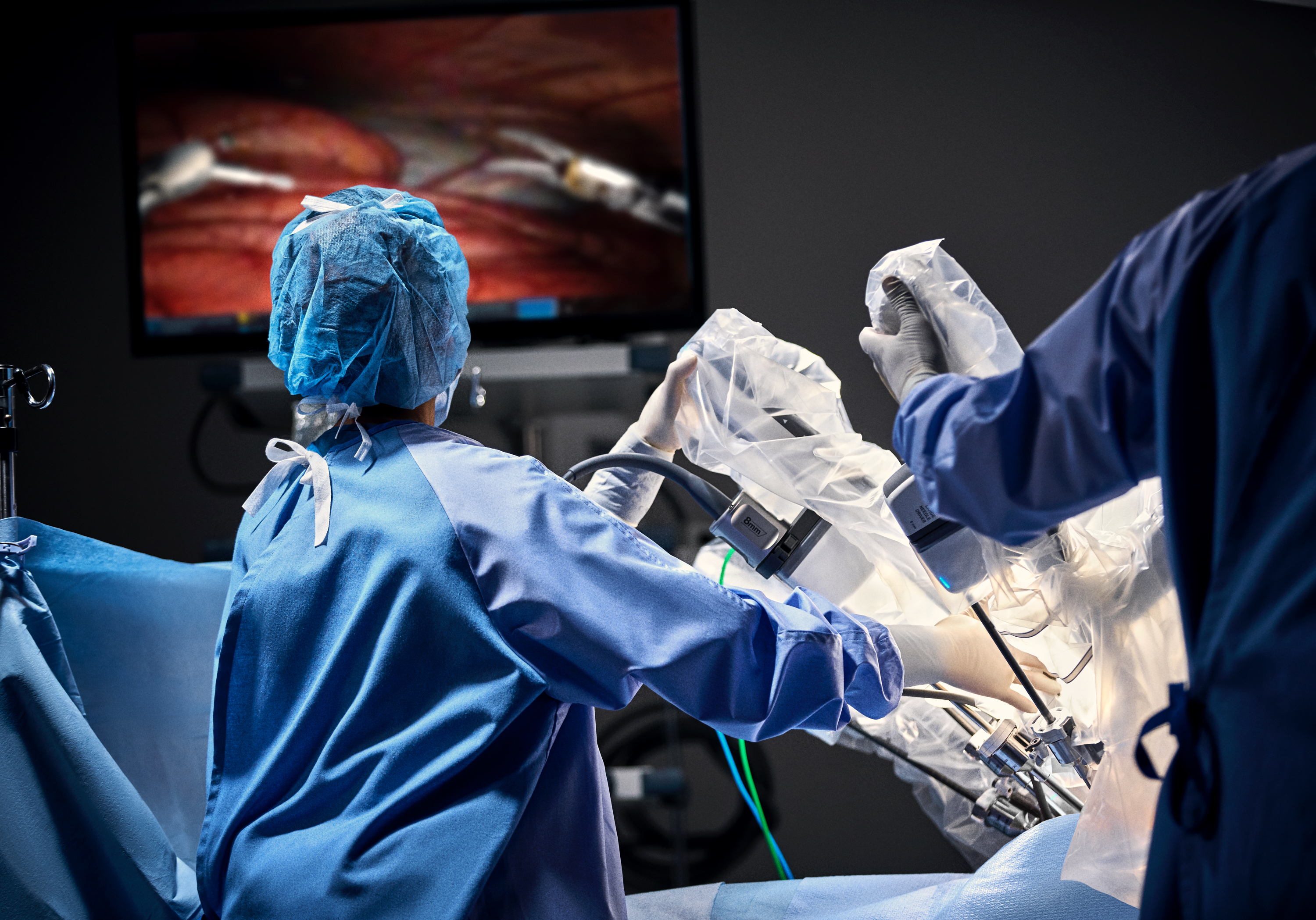 Surgical team working alongside the da Vinci robot and vision cart in the operating room
